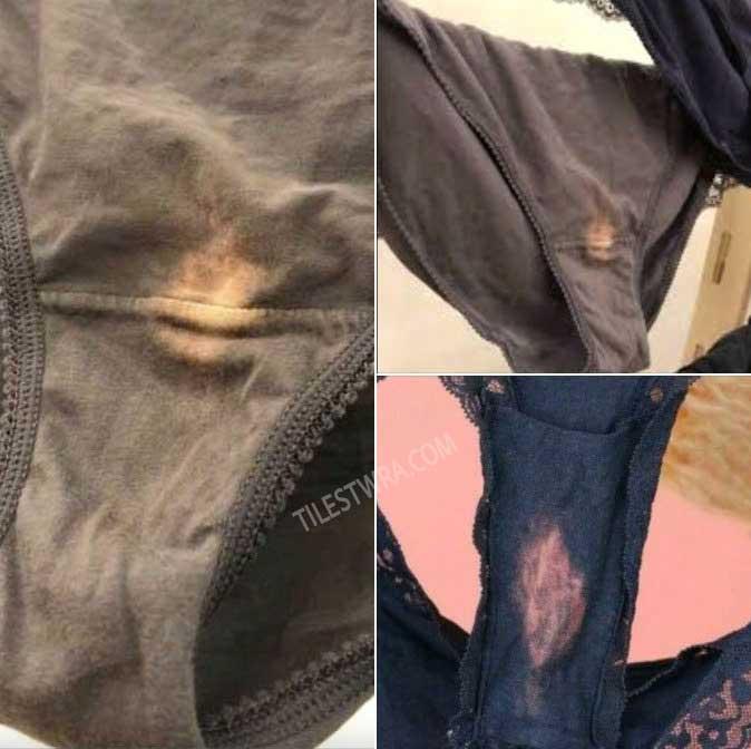 Τι σημαίνει αν δείτε ένα ξεθωριασμένο μέρος στο εσώρουχό σας 2 483509439 1043475204492454 623797971651074954 n