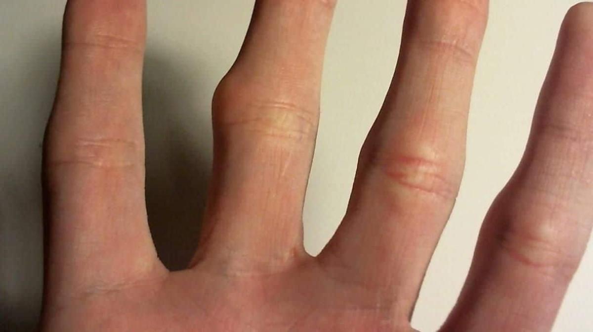 b62dddb2dbd9d5ca3ca3da218f8c6bc6