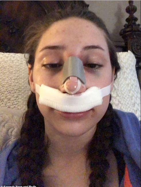 πλαστική στη μύτη