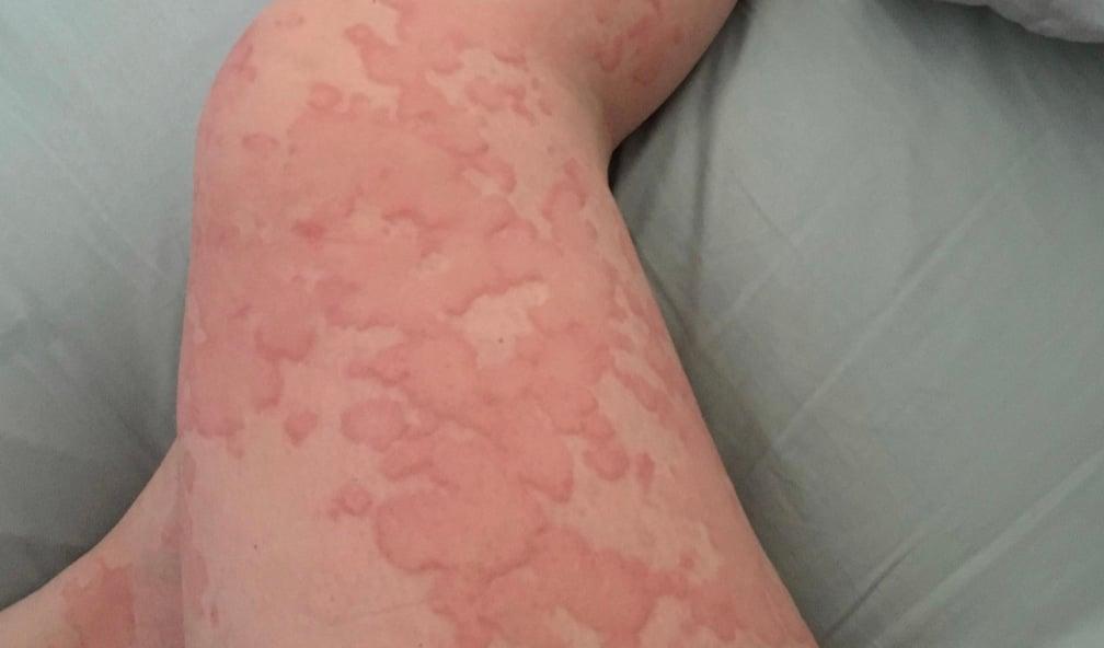 stigmiotypo othonis 2026 01 03 02.11.36