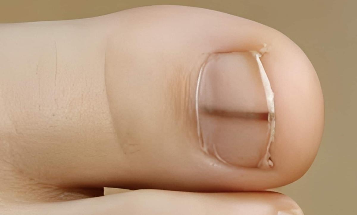 stigmiotypo othonis 2026 01 09 23.44.57