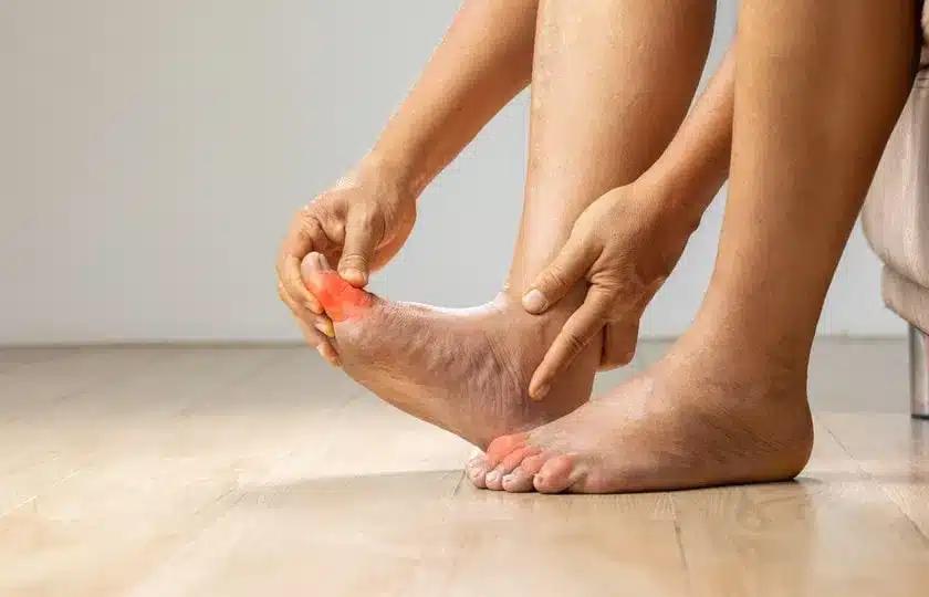 types of edema min min