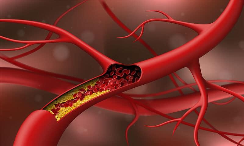 xolisterini fragmenes artiries