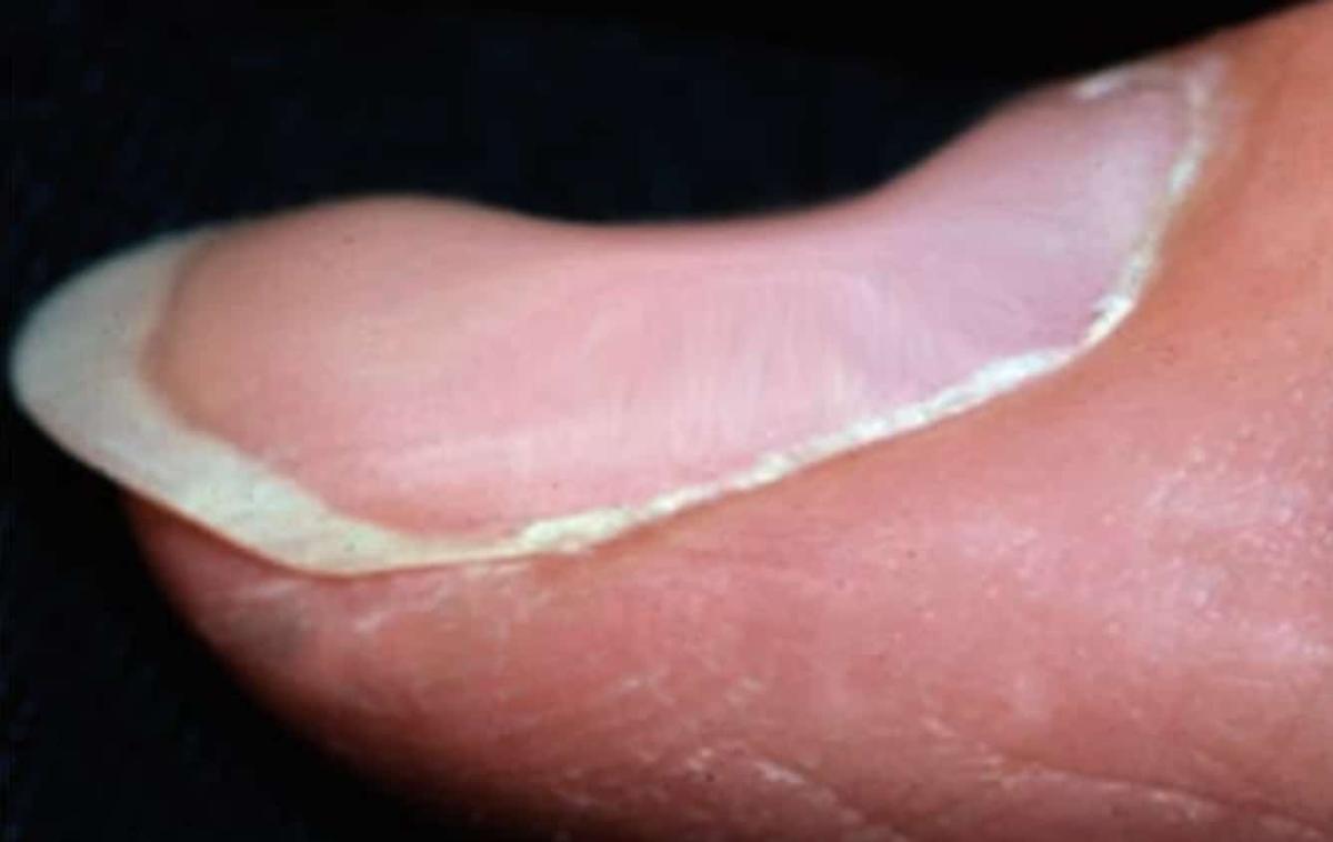 stigmiotypo othonis 2025 10 19 20.59.07