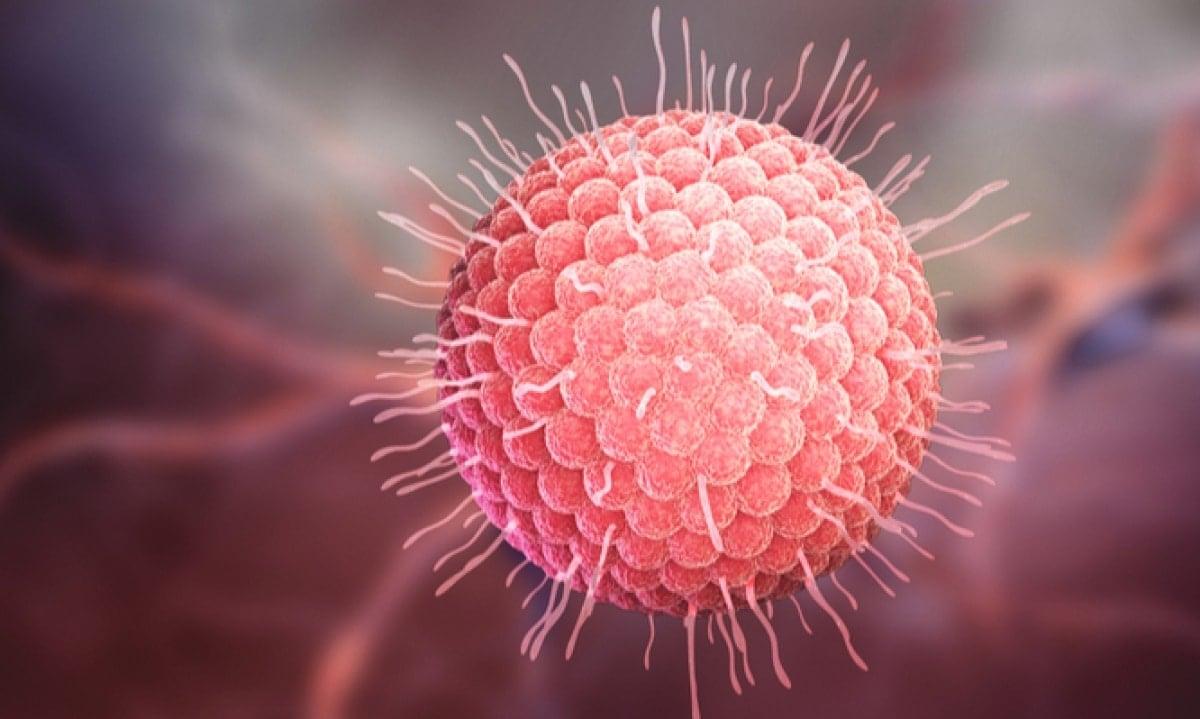 Όλα όσα πρέπει να γνωρίζετε για τα έρπητα ζωστήρα: Aιτίες, έγκαιρη ανίχνευση και φυσικές θεραπείες 5