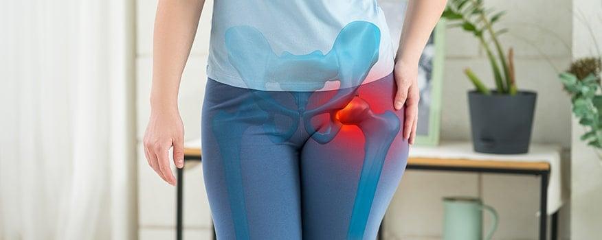 Πόνος στο ισχίο: Tι πραγματικά σημαίνει; 1 hip pain sterling