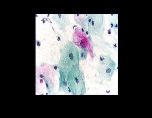 Γεώργιος Παπανικολάου: Ο άνθρωπος που όλες οι γuναίκες οφεiλουν εuγνωμοσύνη 9 73 1