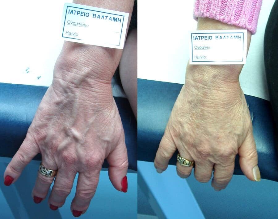 Ο χάρτης της ανθρώπινης κυκλοφορίας και οι βιολογικοί παράγοντες που διαμορφώνουν την ορατότητα του αγγειακού δικτύου 2 rafail 2 prin meta e1642982026172