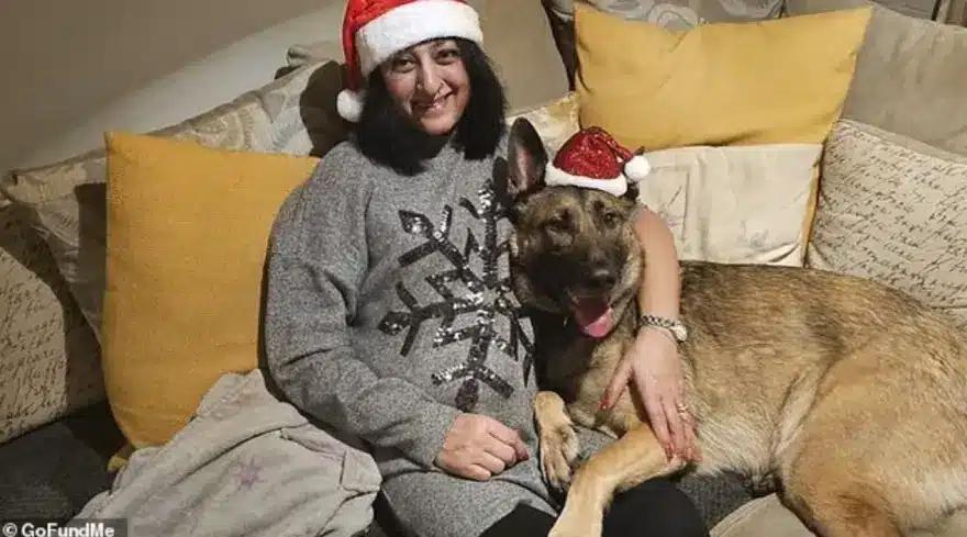 Γυναίκα έχασε όλα τα άκρα της, έπαθε σηψαιμία από σκύλο που της έγλειψε μια πληγή 1 woman sipsi1