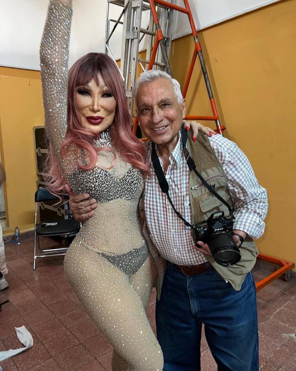 Ήταν μια διάσημη ηθοποιός που εμφανίστηκε σε περίπου 100 ταινίες, αλλά ένα τραγικό λάθος άλλαξε άρδην την εμφάνισή της 7 3 17