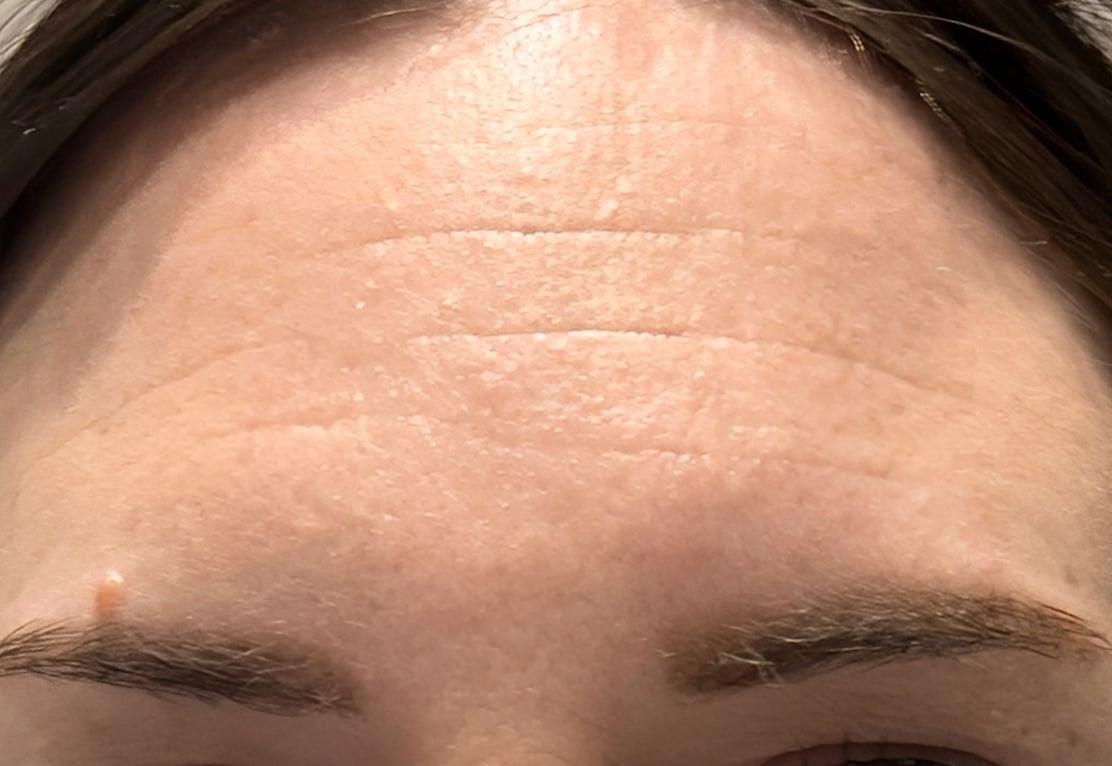 stigmiotypo othonis 2025 10 17 04.28.40