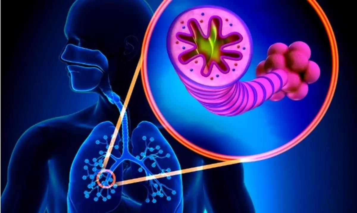 08037flegma vlenna 1200x719 1