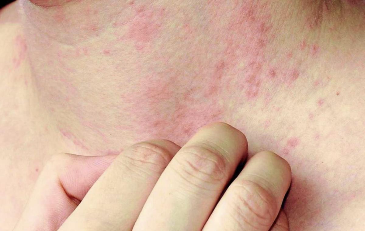 stigmiotypo othonis 2025 07 28 15.23.27