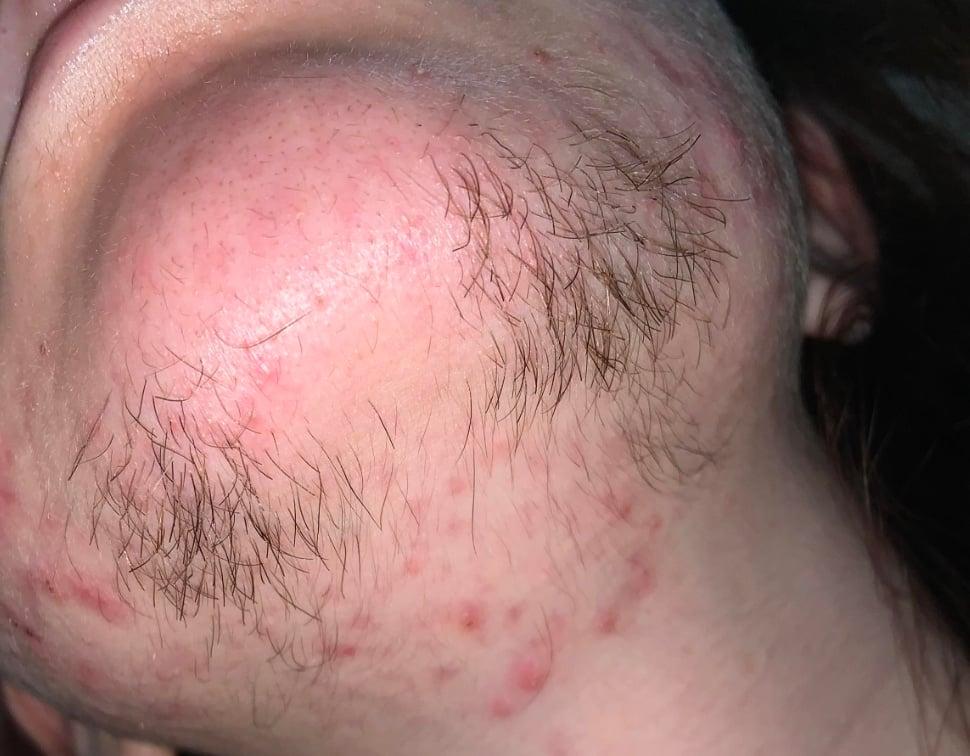 Τι μπορεί να σας λένε οι τρίχες του πηγουνιού για την υγεία σας 4 stigmiotypo othonis 2025 06 27 13.29.20