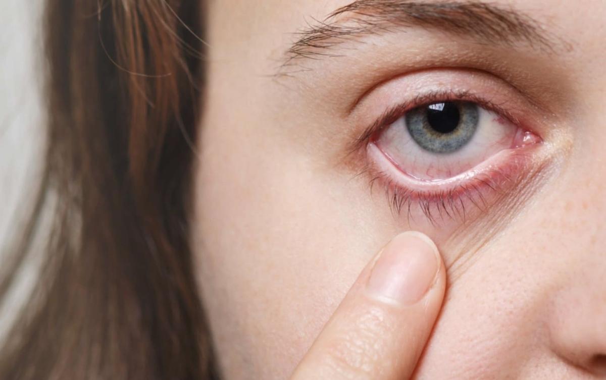 stigmiotypo othonis 2025 08 09 17.44.32