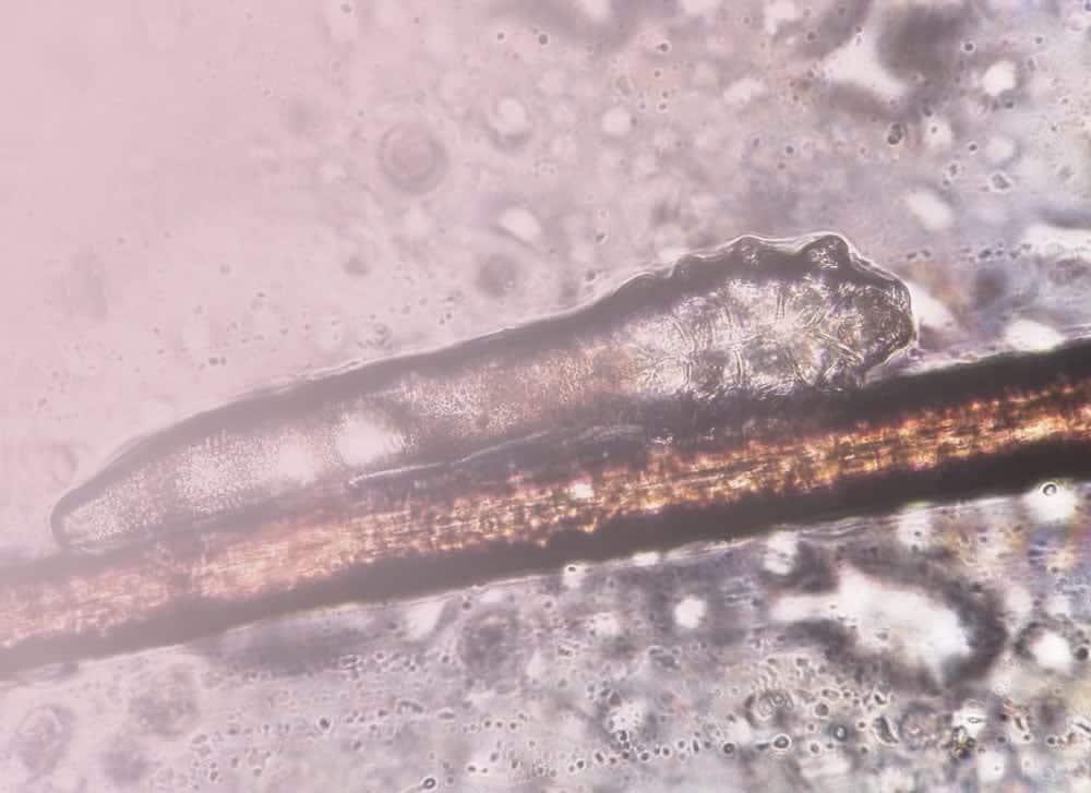 demodex folliculorum