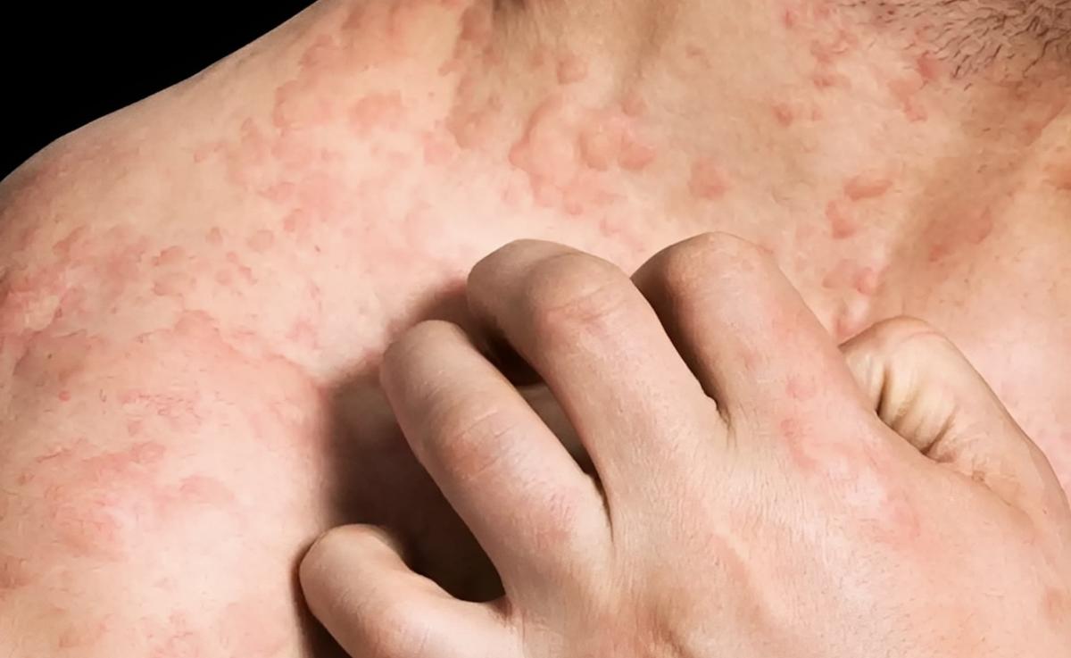 stigmiotypo othonis 2025 08 04 13.29.59