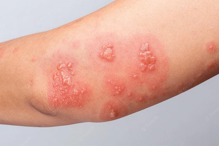 494819094 1602613020366518 3601117942351920871 n