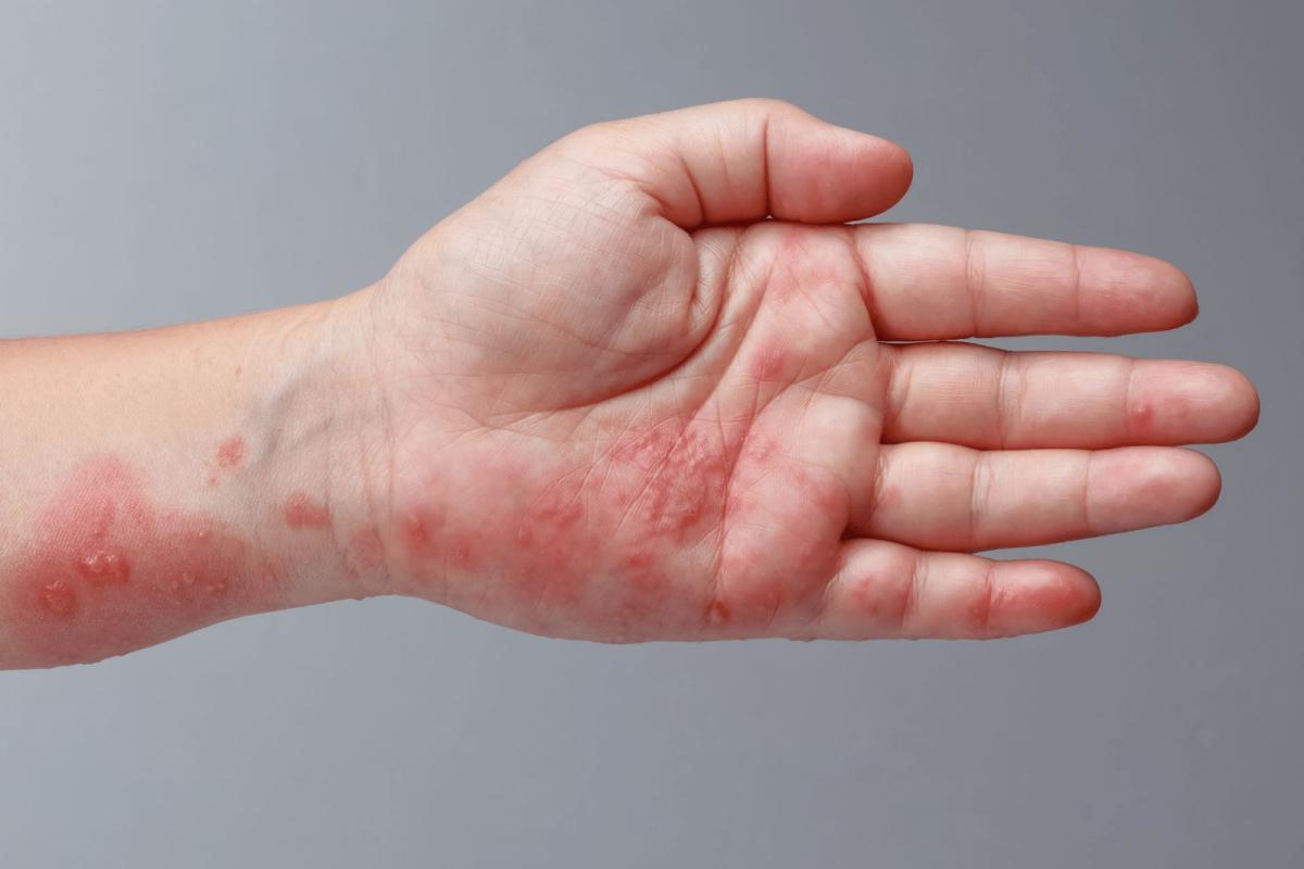 494817025 1803229163868269 4939837139148590519 n 1600x1067 1