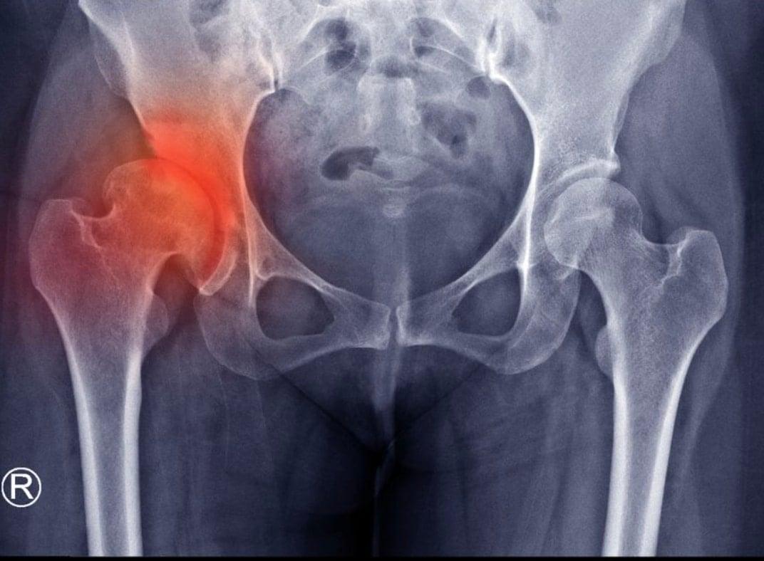 Πόνος stigmiotypo