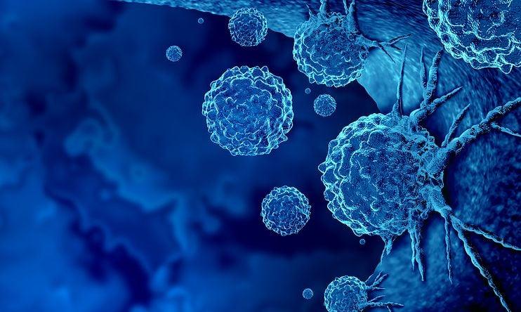 Φαίνονται «αθώα», αλλά προειδοποιοúν για καρκiνο: 6 úπουλα σημάδια που εμφανίζουν σχεδόν όλοι οι καρκινοπαθεiς 2 karkinos