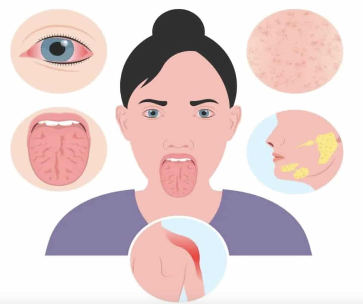 stigmiotypo othonis 2025 10 26 22.20.14