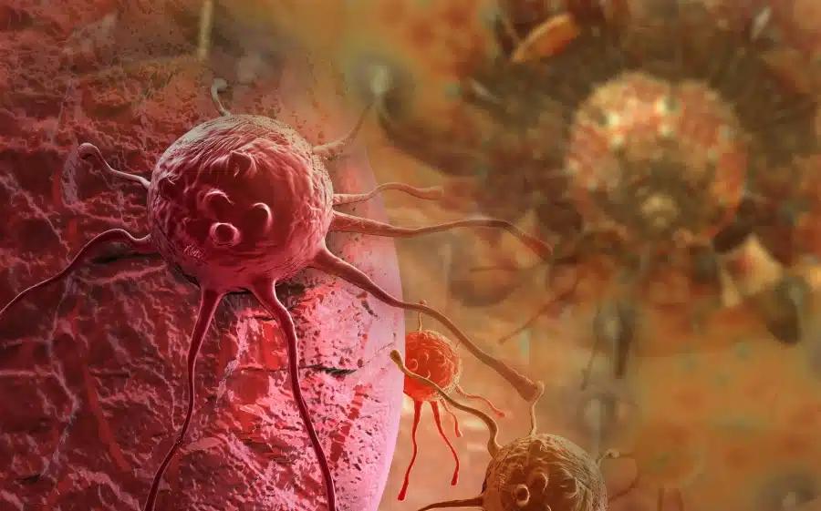 bigstock cancer cell 129640574