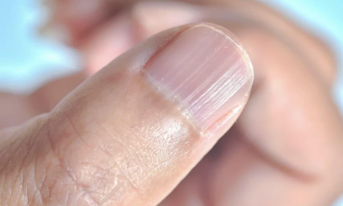 stigmiotypo othonis 2025 11 08 03.09.07