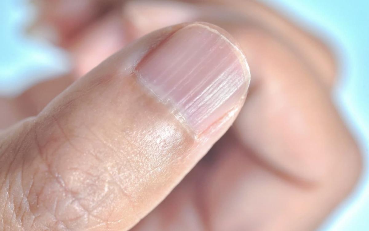 stigmiotypo othonis 2025 06 24 17.18.52