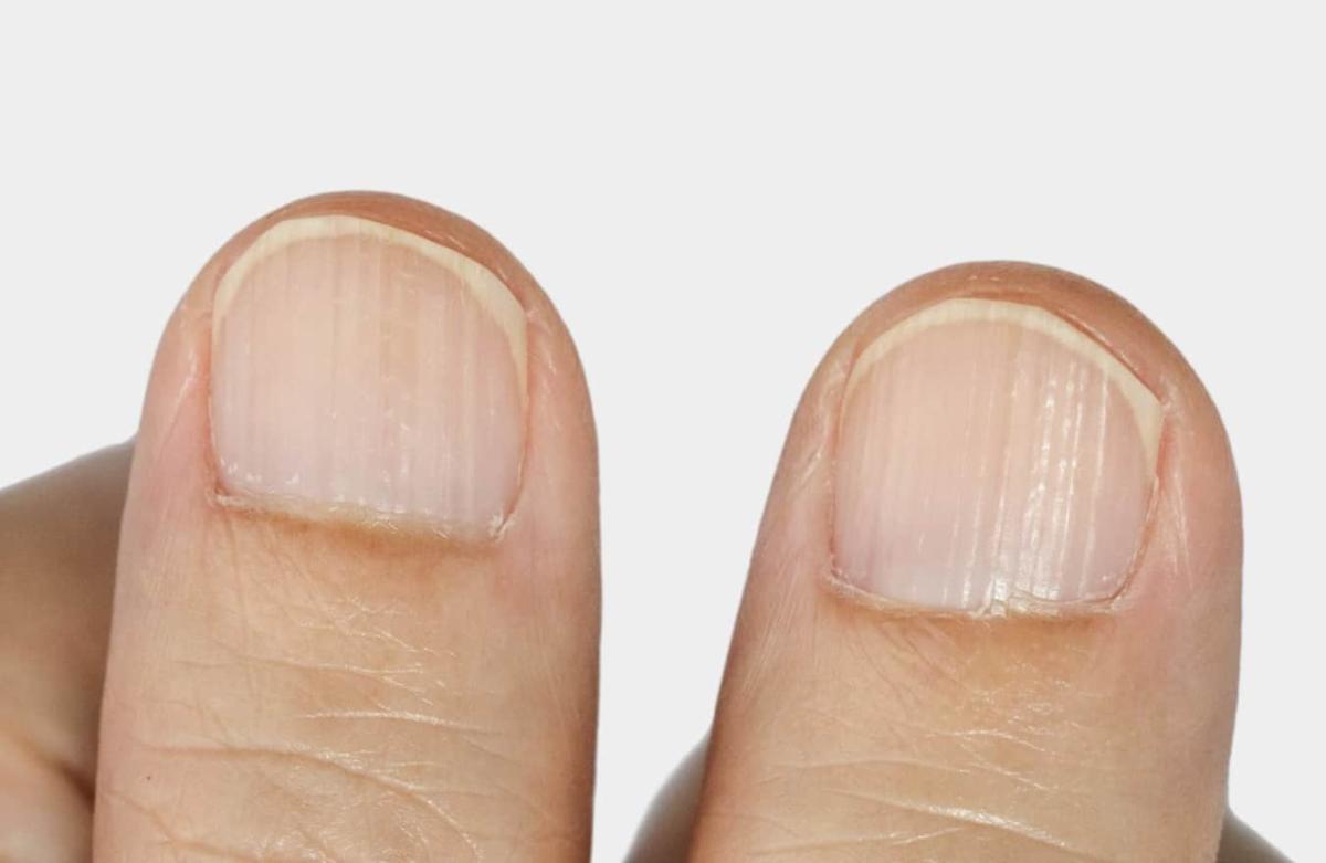 stigmiotypo othonis 2025 06 24 17.19.14