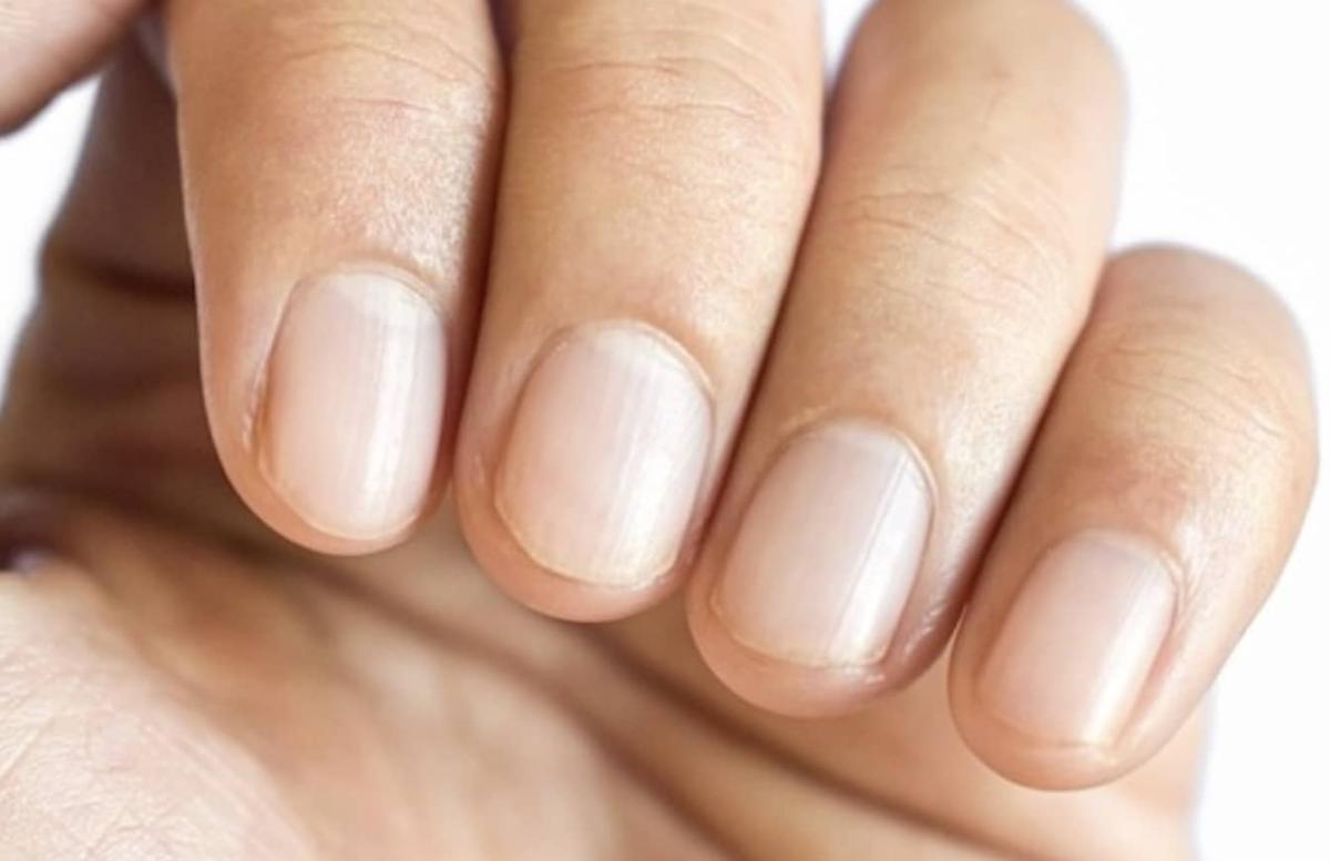 stigmiotypo othonis 2025 06 24 17.19.25