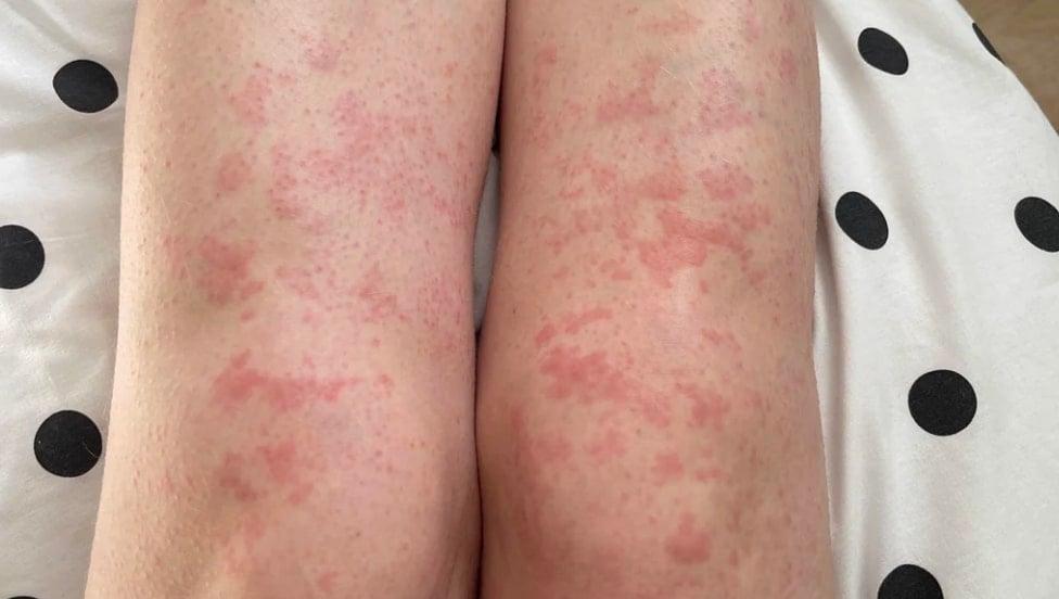 stigmiotypo othonis 2026 01 03 02.11.58