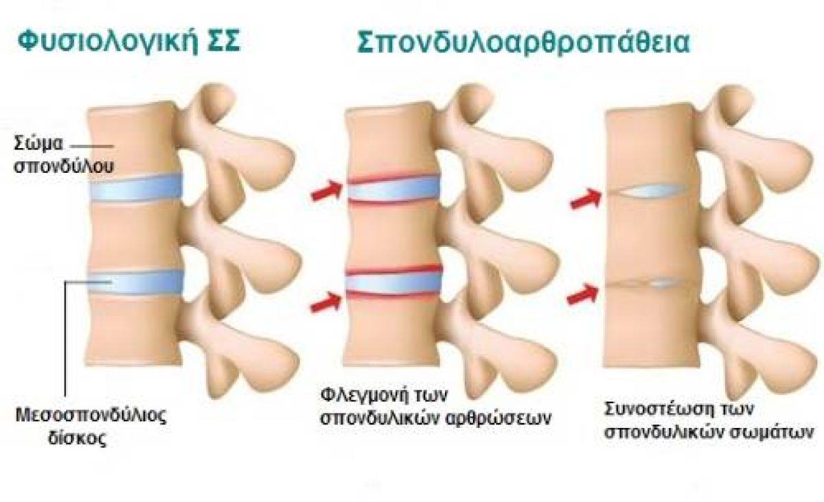 xatzidou4 1
