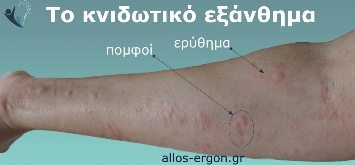 knidotiko