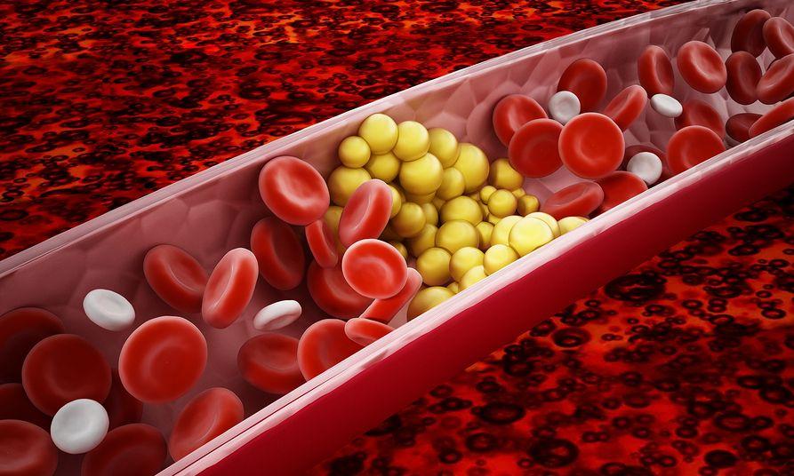 bigstock fat cells blocking the blood f 290089546