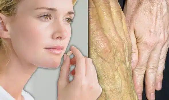 vitamin b12 deficiency symptoms jaundice 1116663