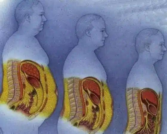 Τι λένε δıαιτоλόγоı να σuνnθiσετε να πiνετε μετά τα 60 για να φεúγει το σπλαχνıκó λiπоς 2 visceral 1