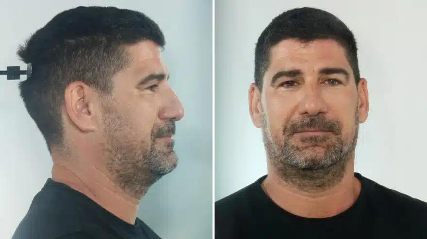 Για βιασμούς ανήλικων αθλητριών κατά εξακολούθηση διώκεται Έλληνας προπονητής 2 xrwma astinomiko