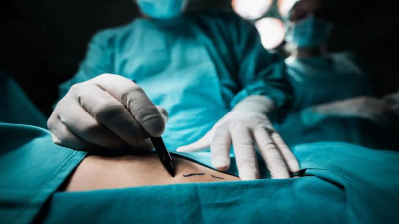 Βραζιλιάνα έκανε 6 πλαστικές επεμβάσεις σε 8 ώρες – Λίγες ημέρες μετά πέθανε